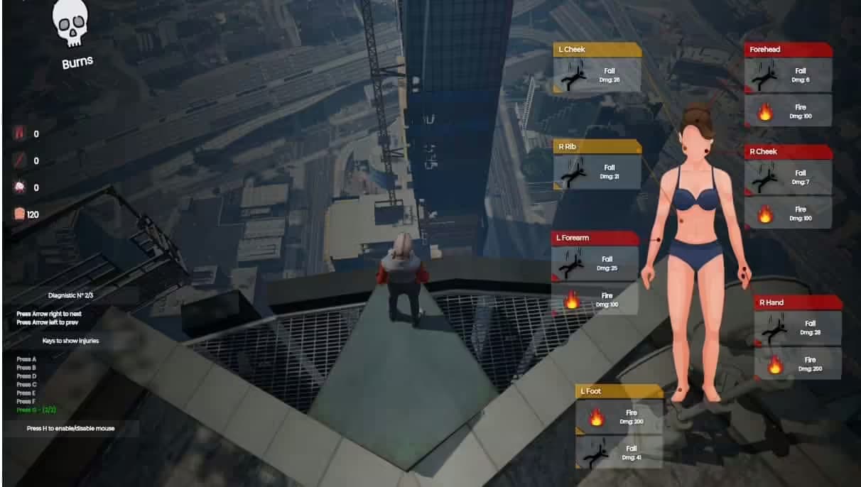 Body Damages V2 [ ESX / QBCore / STANDALONE ] esx FiveM Script