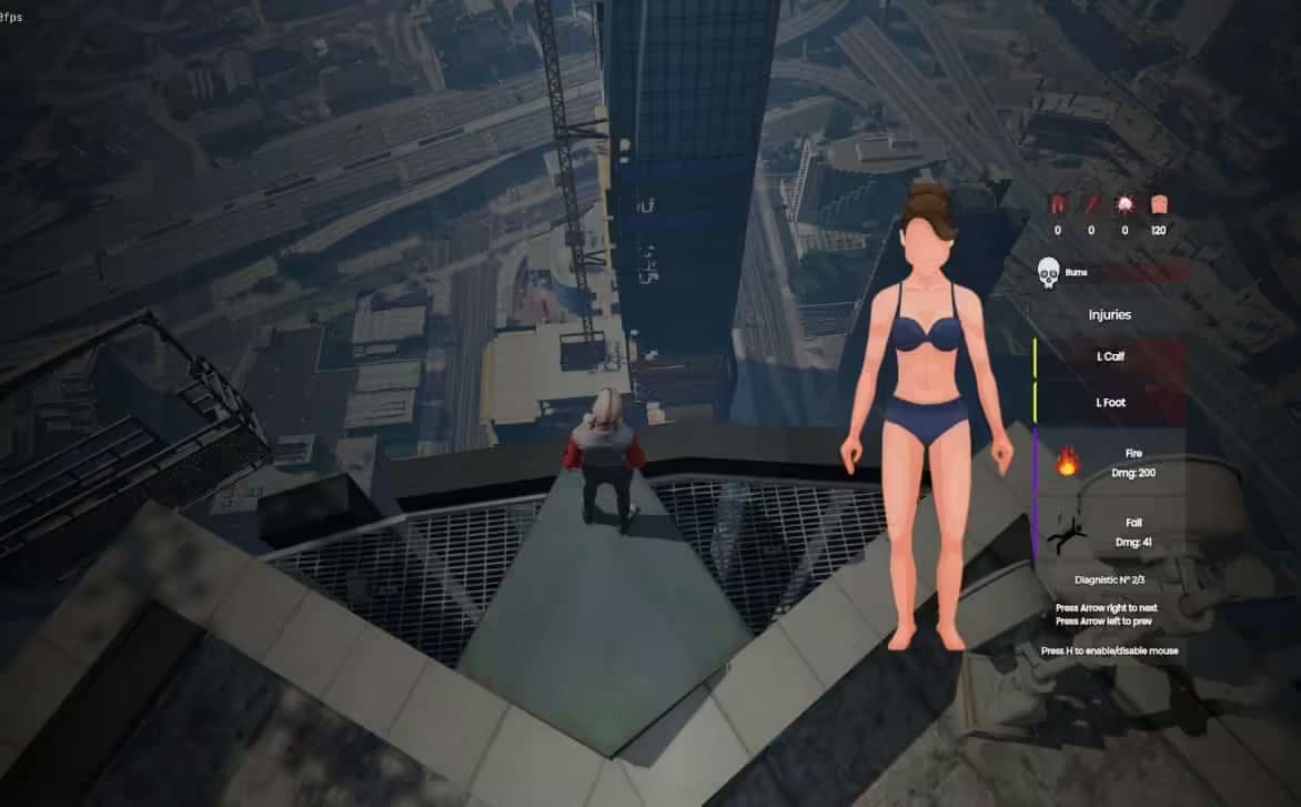 Body Damages V2 [ ESX / QBCore / STANDALONE ] FiveM Script — esx 2